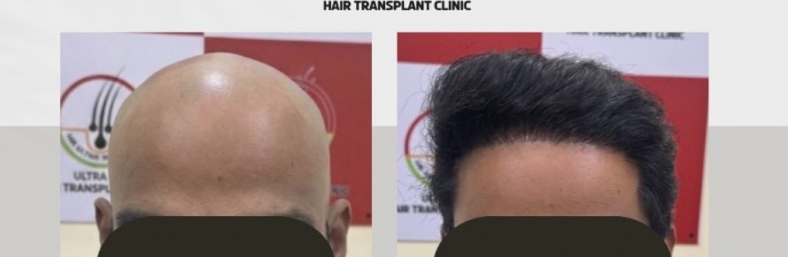 ultrabio hair bangalore Cover Image