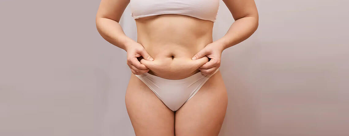 Liposuction Care After Surgery | Liposuction Surgery in Delhi
