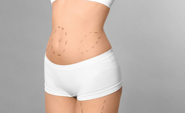 What is the Best Age for Liposuction Surgery? – Dr Rajat Gupta
