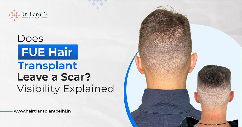 Does FUE Hair Transplant Leave a Scar? Expert Insights Explained