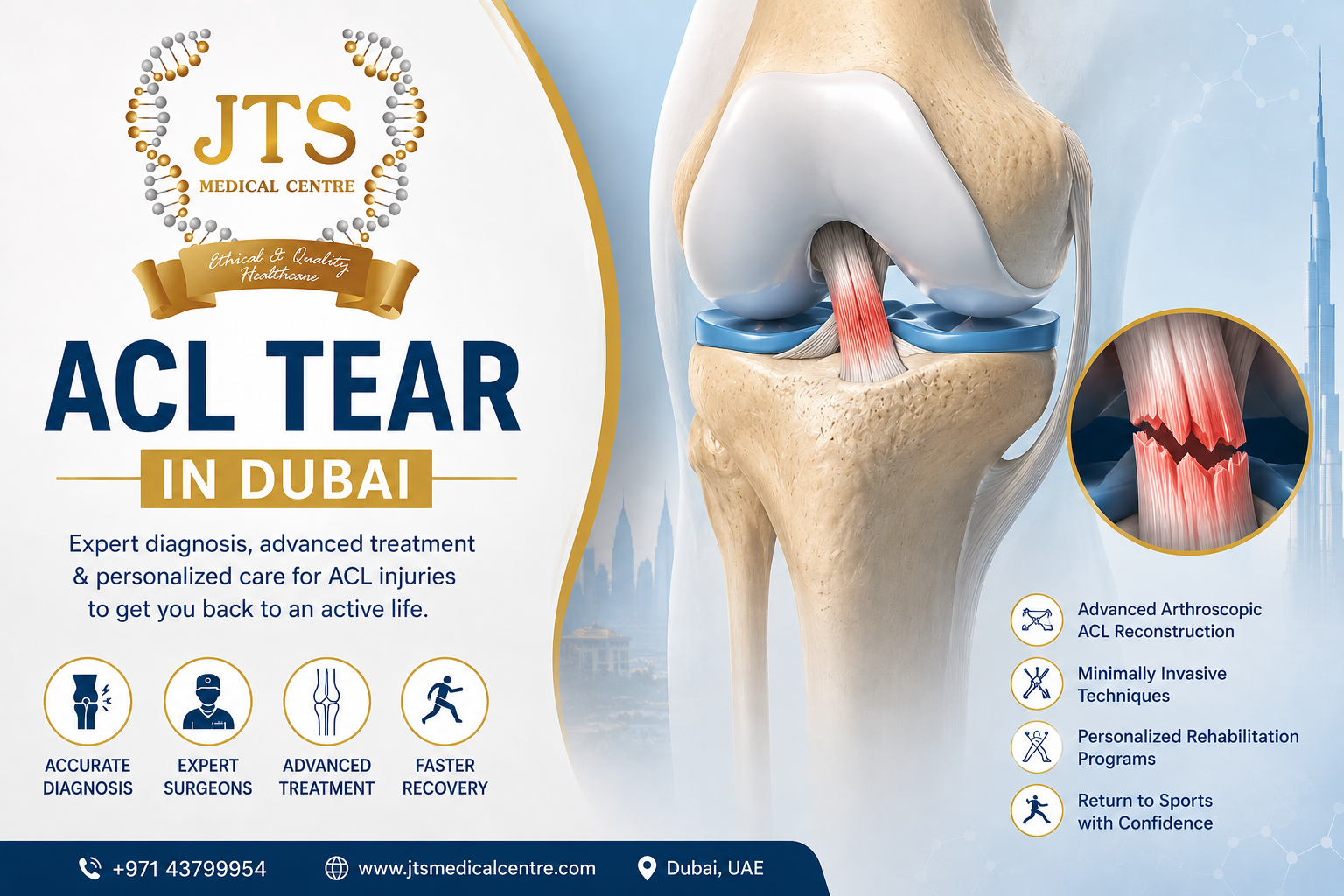 ACL Tear in Dubai: Signs, Treatment Options, and Recovery Without Losing 6 Months of Training  – Medical Centre Dubai