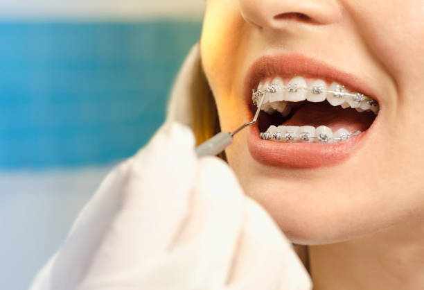Get a Healthier and More Confident Smile with Orthodontic Treatment
